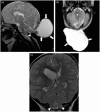 Figure 16.