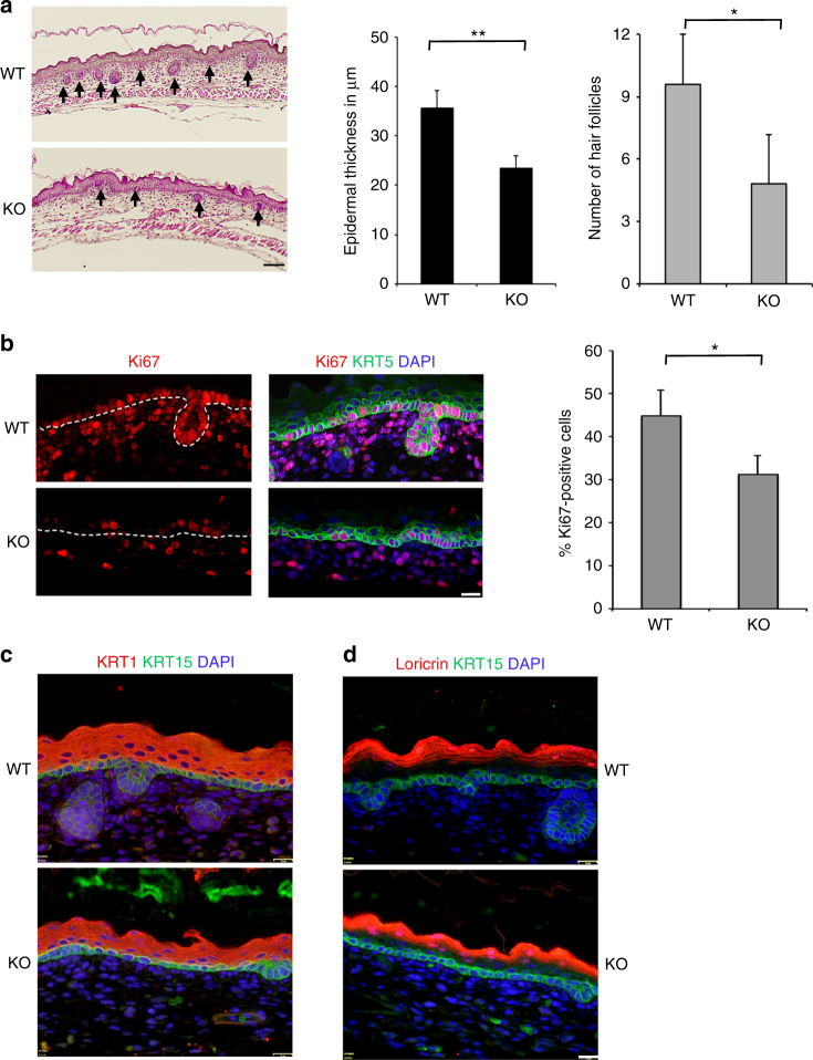 The RNA-binding protein YBX1 regulates epidermal progenitors at a ...