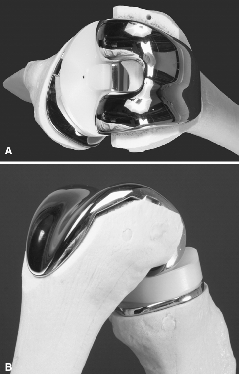 Fig. 1A–B