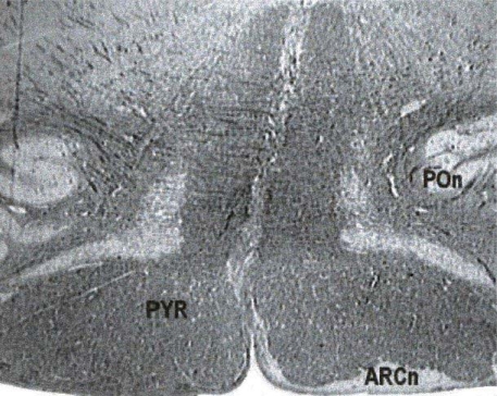 Fig. (3)