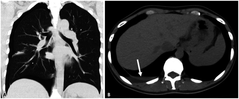 Fig. 13