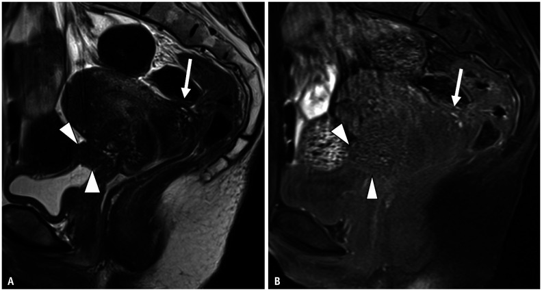 Fig. 11