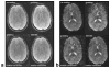 FIG. 7