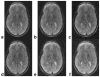 FIG. 6