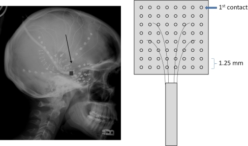 Fig. 1