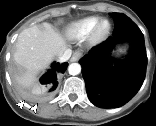 Figure 1c: