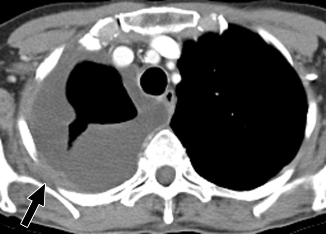 Figure 1a: