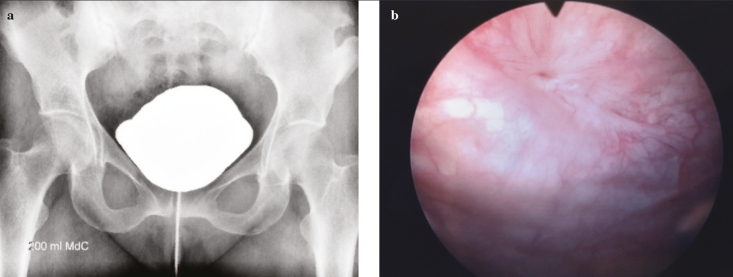 Figure 3. a, b