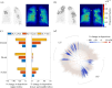 Data from simulations with six clusters of distal airway constriction (severity 0.9) in the upper lobes
