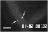 Fig. 11