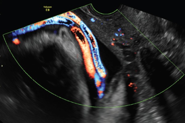 Figure 15