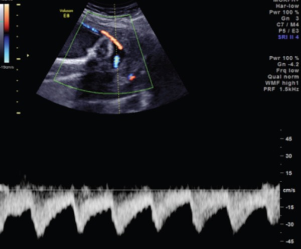 Figure 14