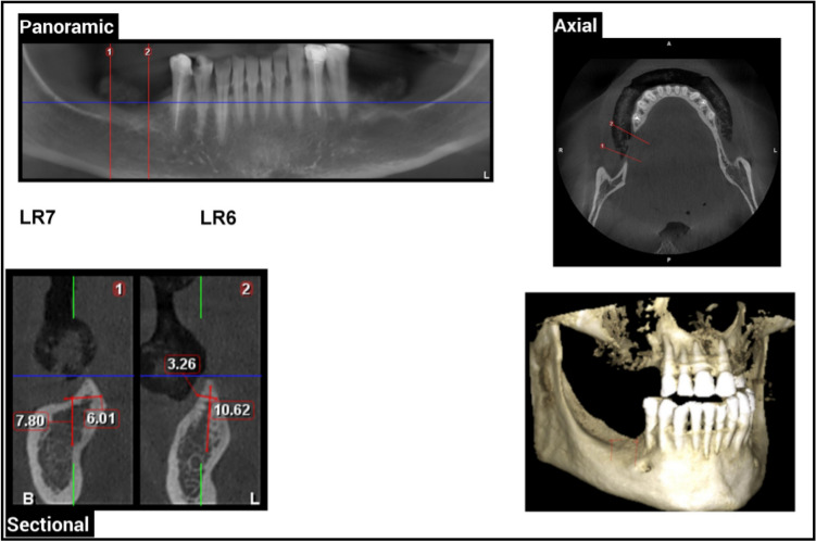 Fig. 1
