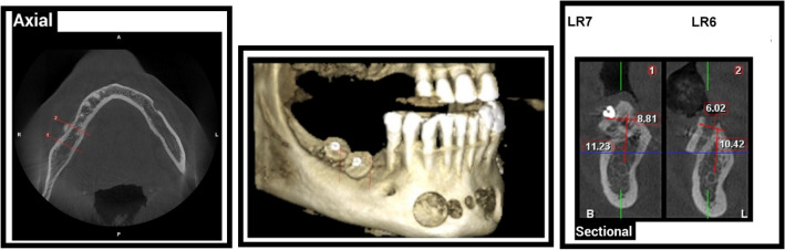 Fig. 10