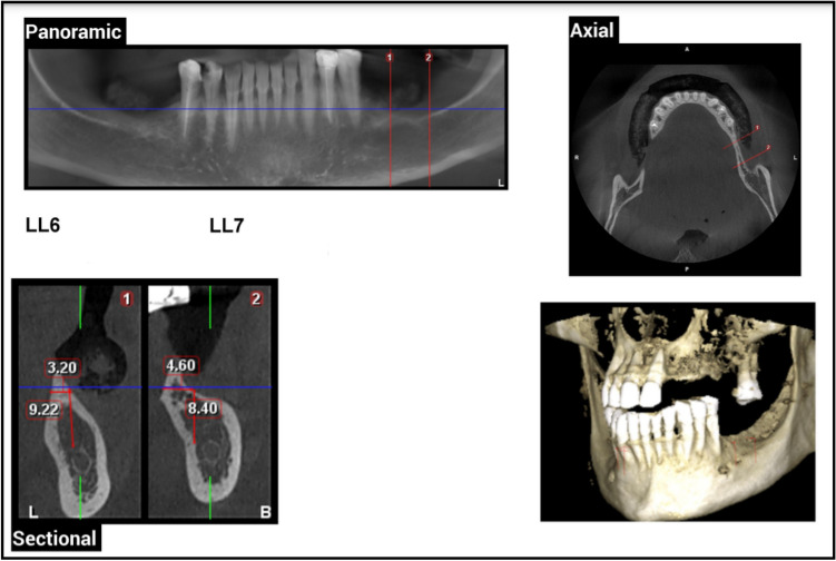 Fig. 2