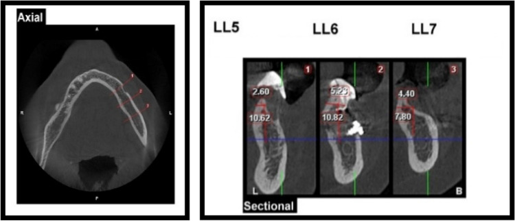 Fig. 11