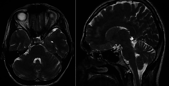 FIG. 1