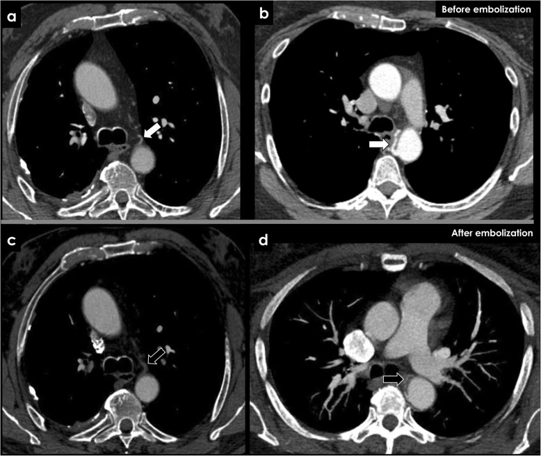 Fig. 14