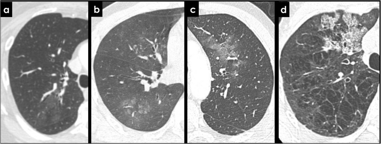Fig. 12