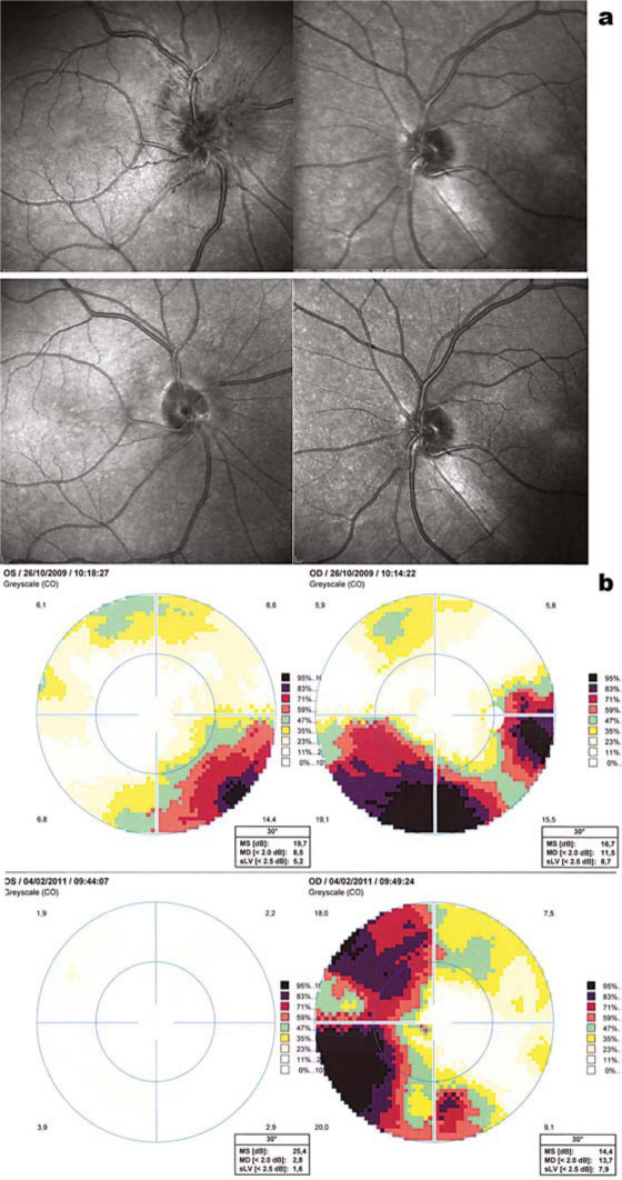 Fig. 1