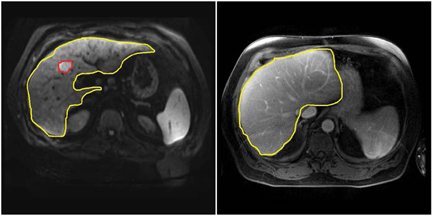 Figure 2-1: