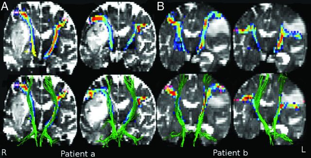 Fig 3.