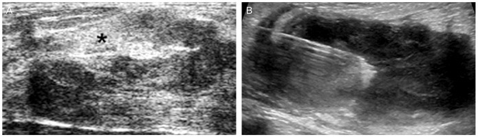 Fig. 11