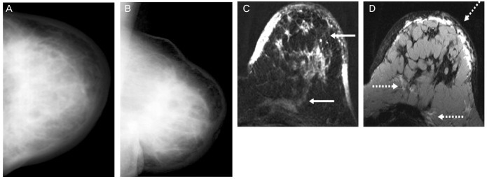 Fig. 17