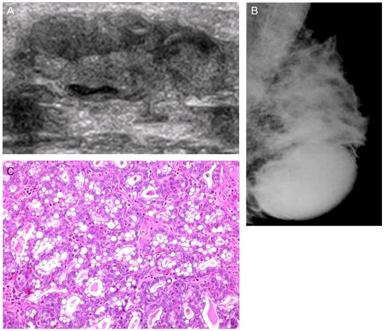 Fig. 15