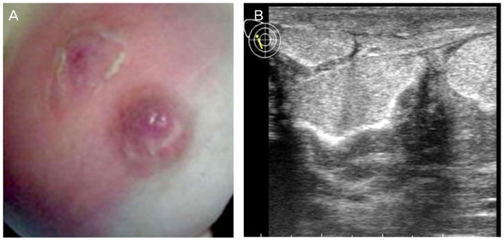 Fig. 12