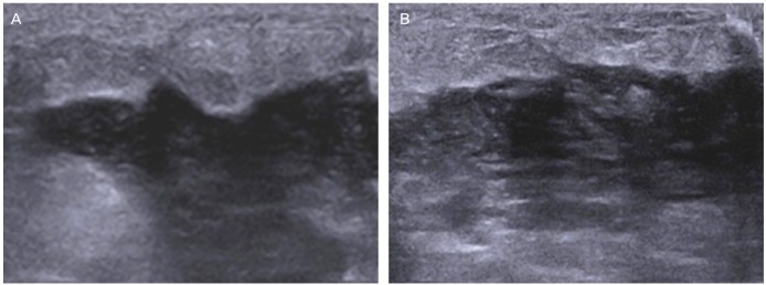 Fig. 13