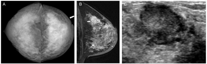 Fig. 18