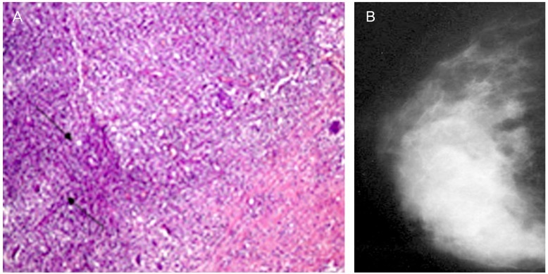 Fig. 14