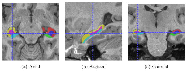 Fig. 5