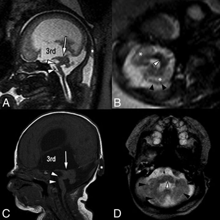 Fig 6.