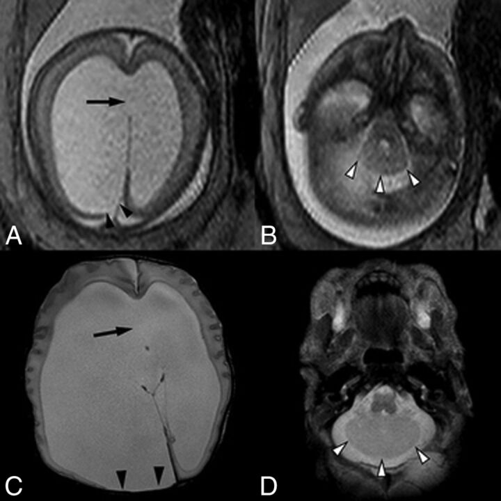 Fig 4.