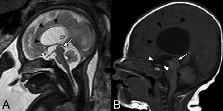 Fig 3.