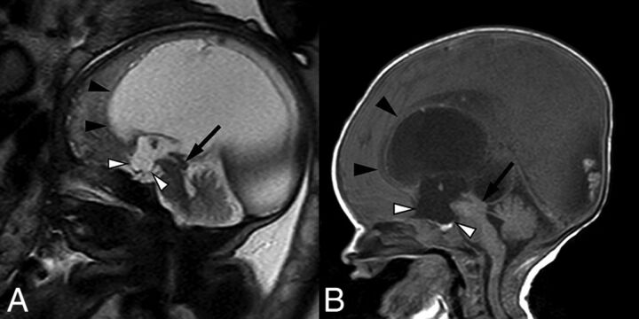 Fig 2.