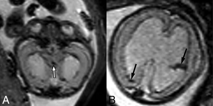 Fig 5.