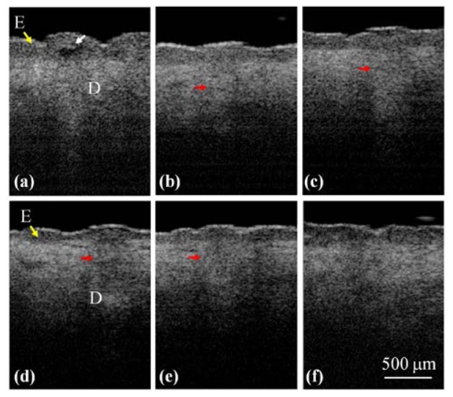 Fig. 4