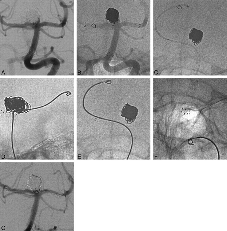 Fig 2.