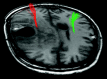 Fig 4.