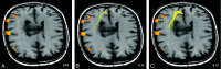 Fig 5.