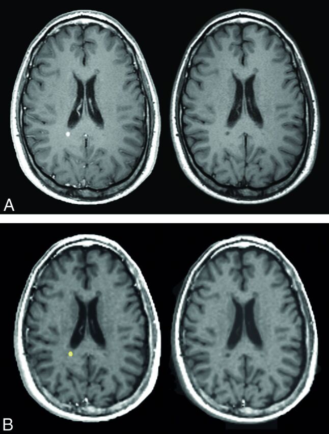 Fig 3.