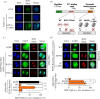 Control of mitotic H2B S6ph by RepoMan phosphorylation.