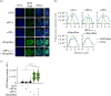 Control of spatial distribution and intensity of mitotic H2B S6ph by RepoMan and PP1.