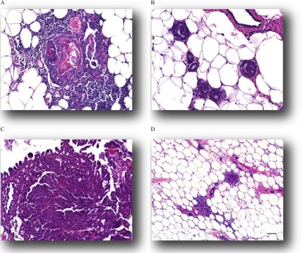 Histological images of mammary lesions