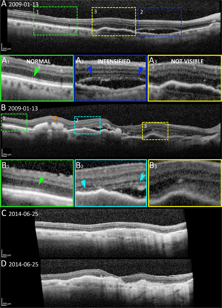 Fig. 2