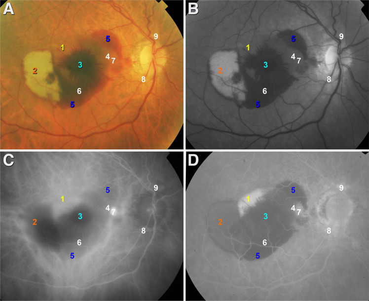 Fig. 1