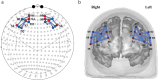 Diagram illustrating brain activity measurement. Panel (a) shows a top view of the scalp with sensors indicated as dots, connected by lines. Panel (b) displays a 3D brain model with highlighted regions connected by blue paths labeled D1 to D8 and S1 to S8, identifying areas of interest.
